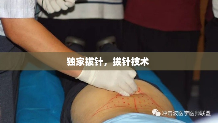 独家拔针，拔针技术 
