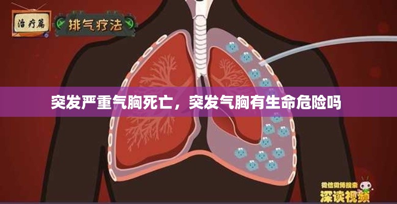 突发严重气胸死亡，突发气胸有生命危险吗 
