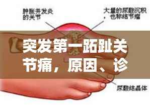 突发第一跖趾关节痛,原因、诊断与治疗方法全解析